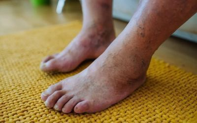 🔥Special Offer🔥 - CozyStep™ Orthopedic Slip-on Shoes with Fleece Lining